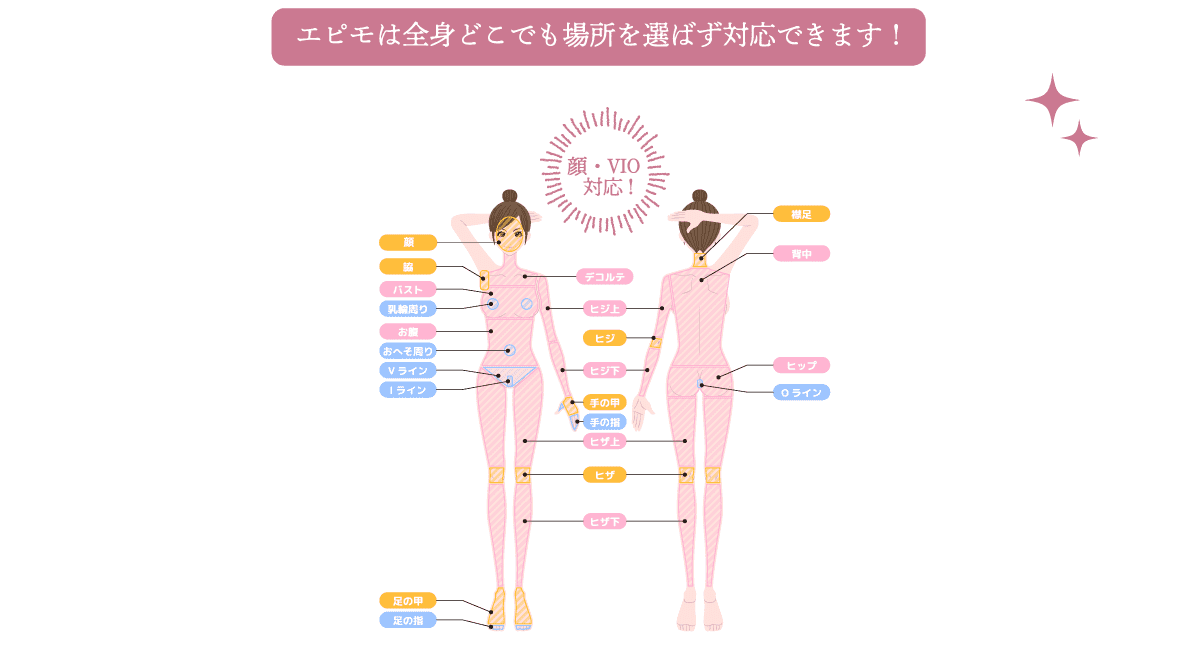 エピモは全身どこでも場所を選ばず対応できます！